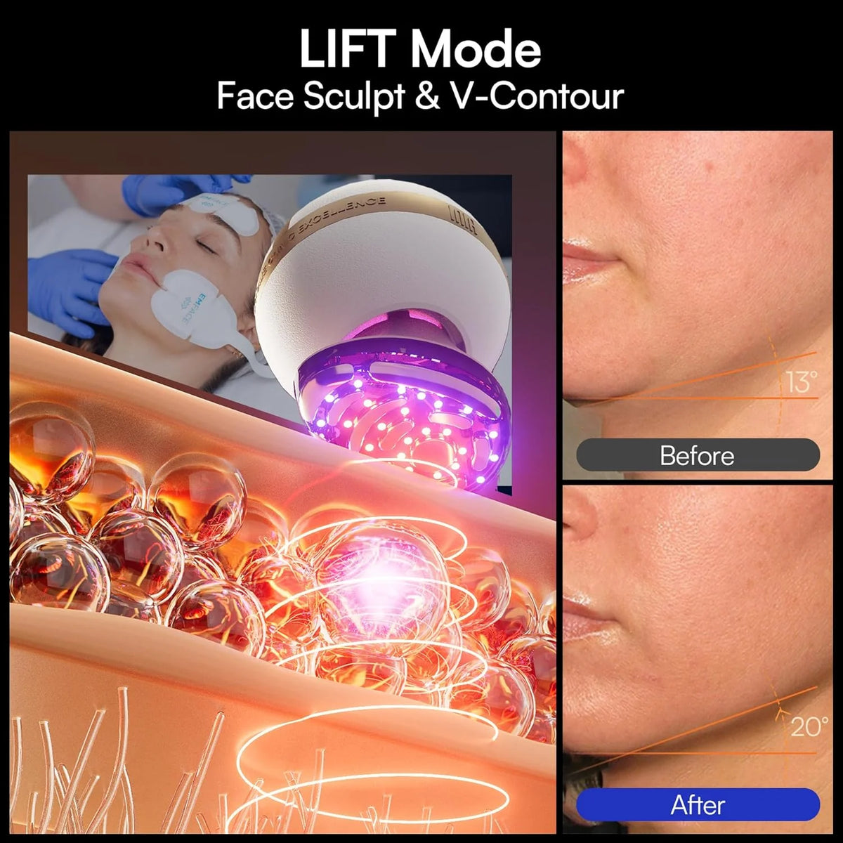 INIA SPHERA Upgraded 8-in-1 Microcurrent Facial Device for Face & Neck Red Light